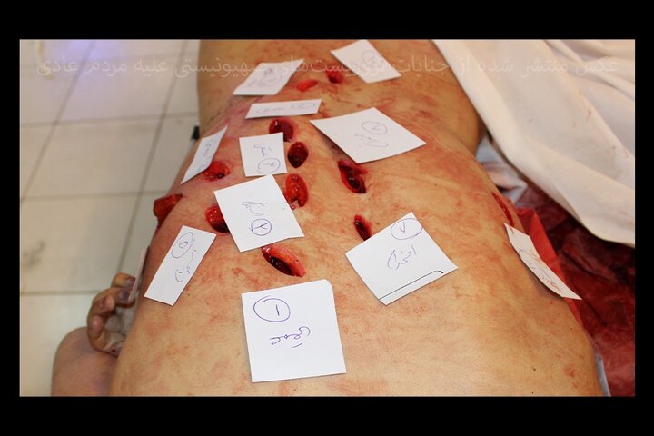 حمله تروریست به ارگان‌های حیاتی بدن؛دیدن این تصاویر برای همه جایز نیست – آفتاب نو |  اخبار ورزشی